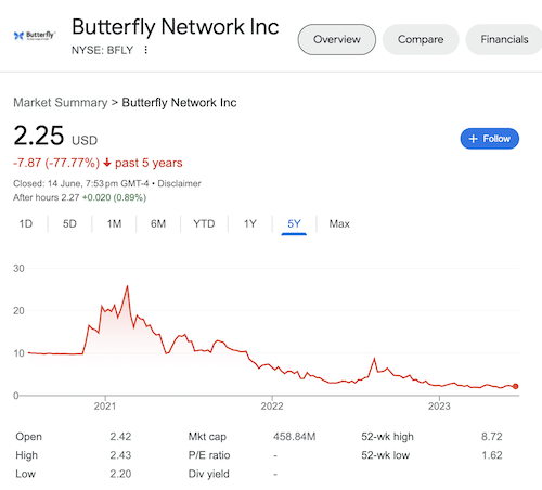 A stock chart of Butterfly Network taken from Google search.